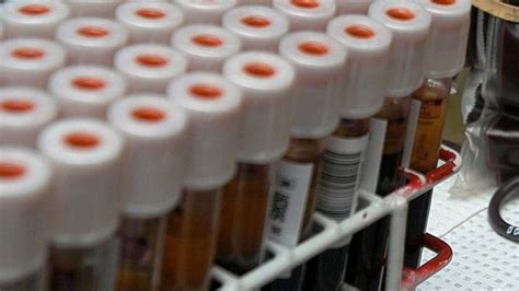 Judge’s decision could force change in Michigan’s handling of newborn blood samples